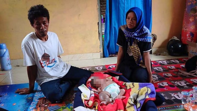 Prihatin, Kondisi Kaki dan Perut  Sang Bayi Bengkak